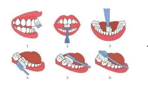 电动刷牙的正确方法视频,高效清洁，呵护口腔健康